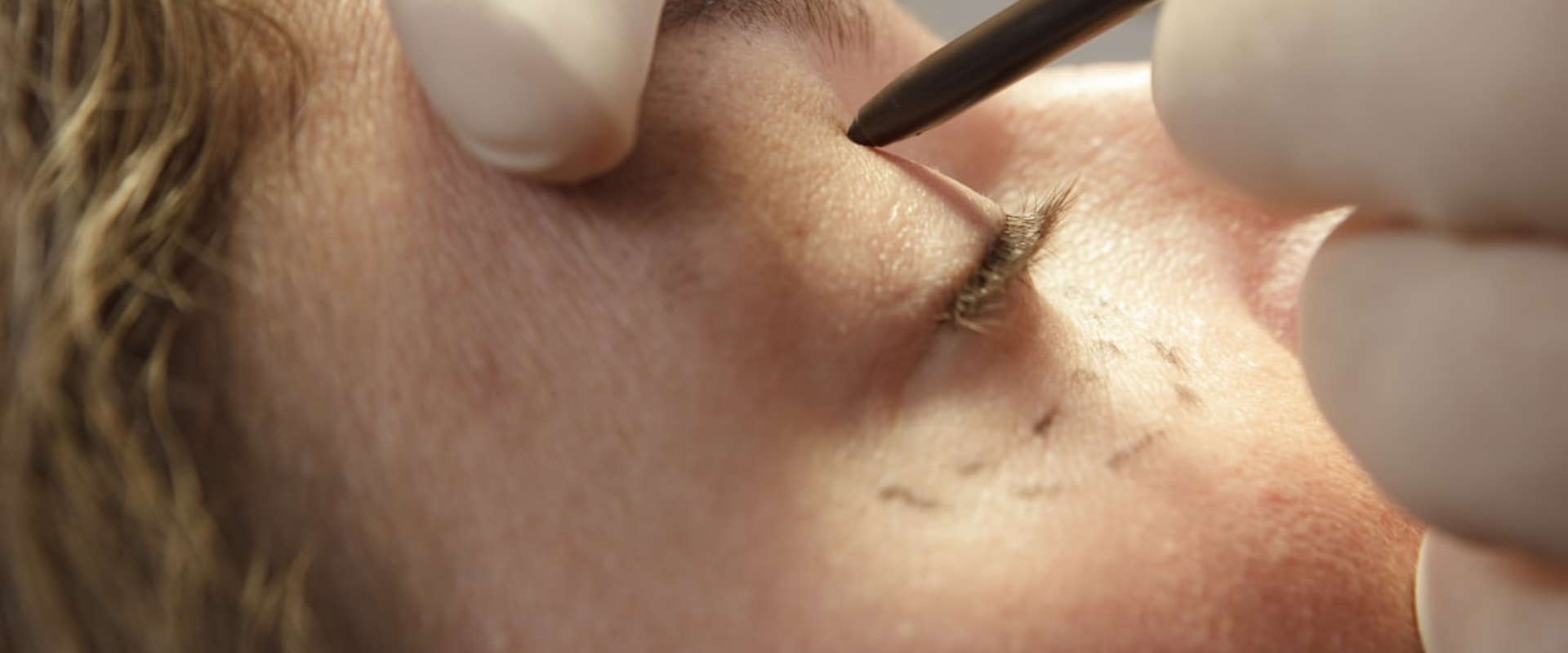 Everything You Need to Know About Plastic Surgery