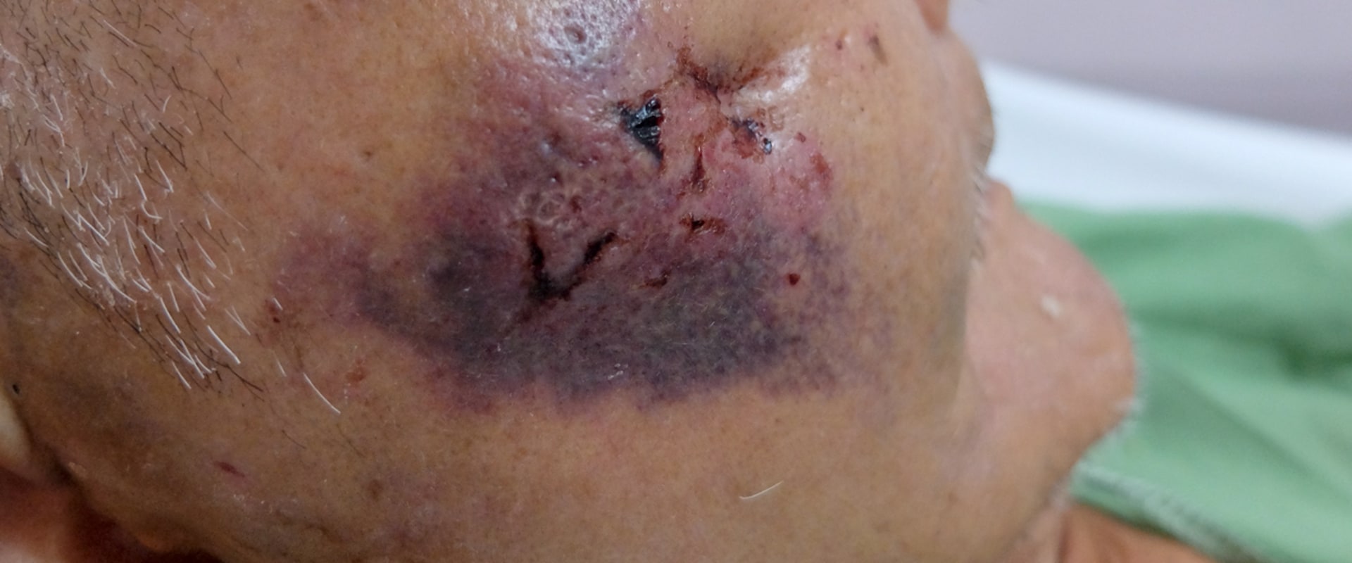 The Risks and Dangers of Cosmetic Surgery