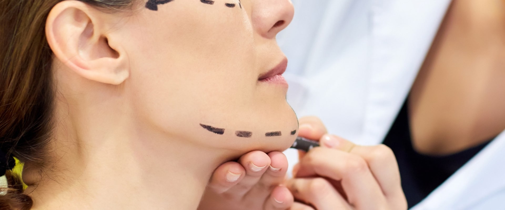 What Cosmetic Surgery Do I Need? A Comprehensive Guide