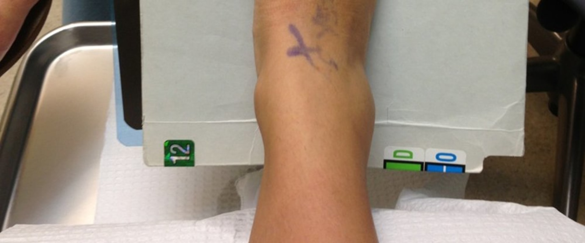 Dr Bill Releford, Podiatrist: Expert Cosmetic Surgery for Beautiful, Healthy Feet