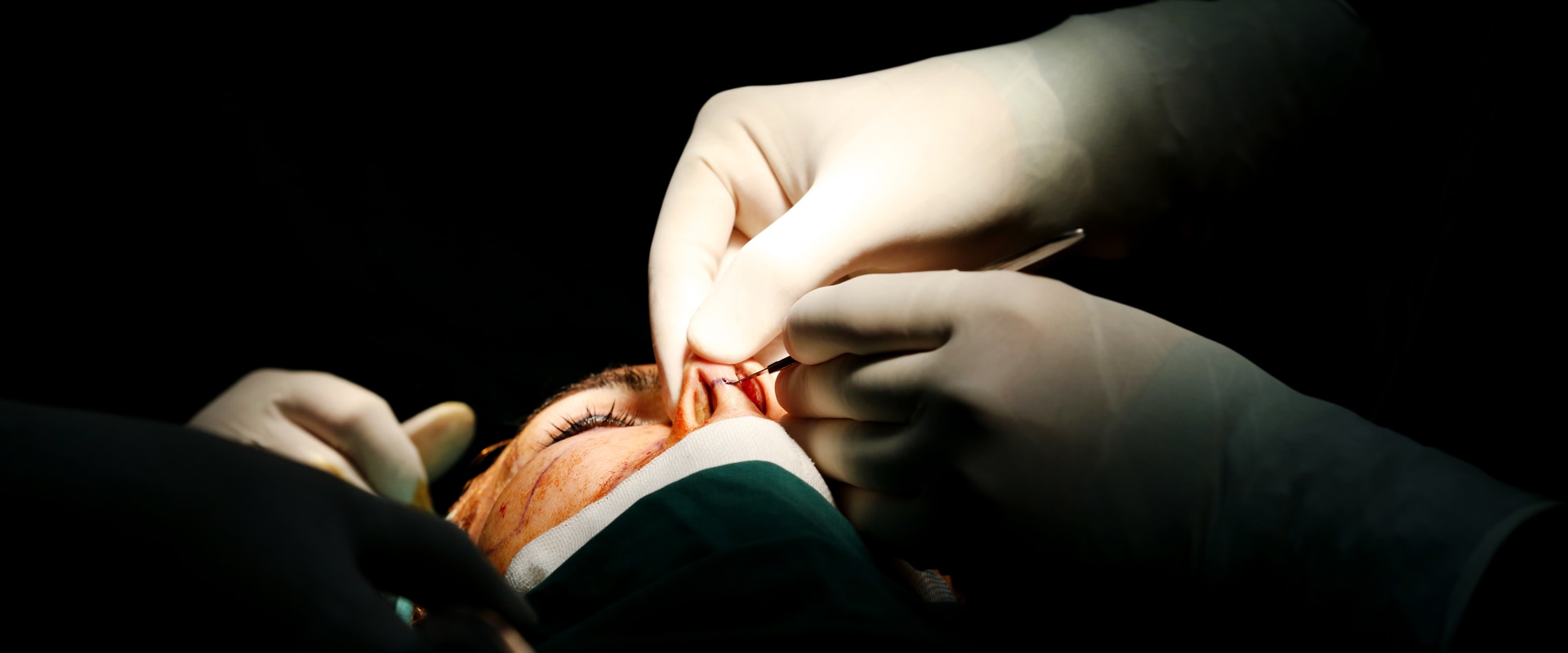 What Cosmetic Surgery Will Insurance Cover?