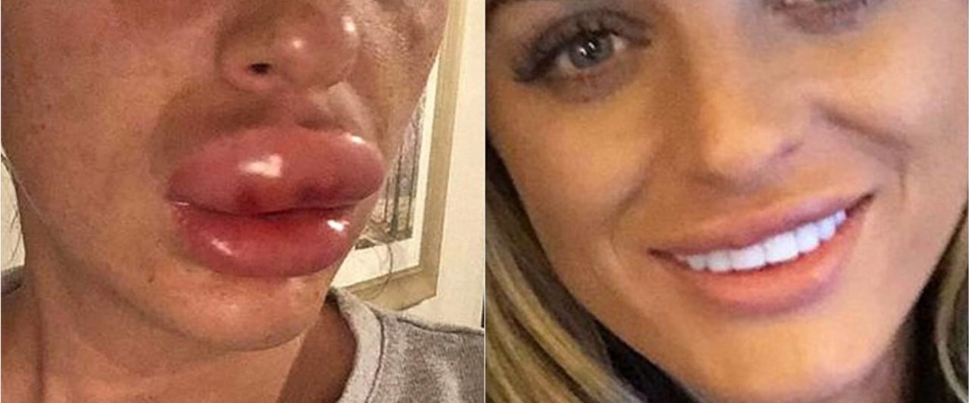 The Most Painful Cosmetic Surgeries: What You Need to Know