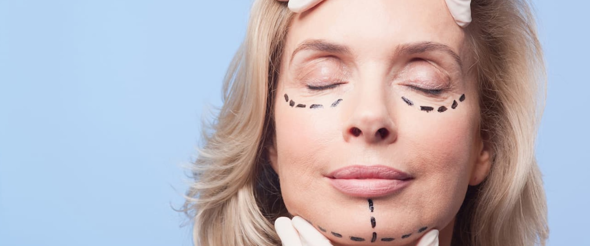Can cosmetic surgery be claimed on taxes?