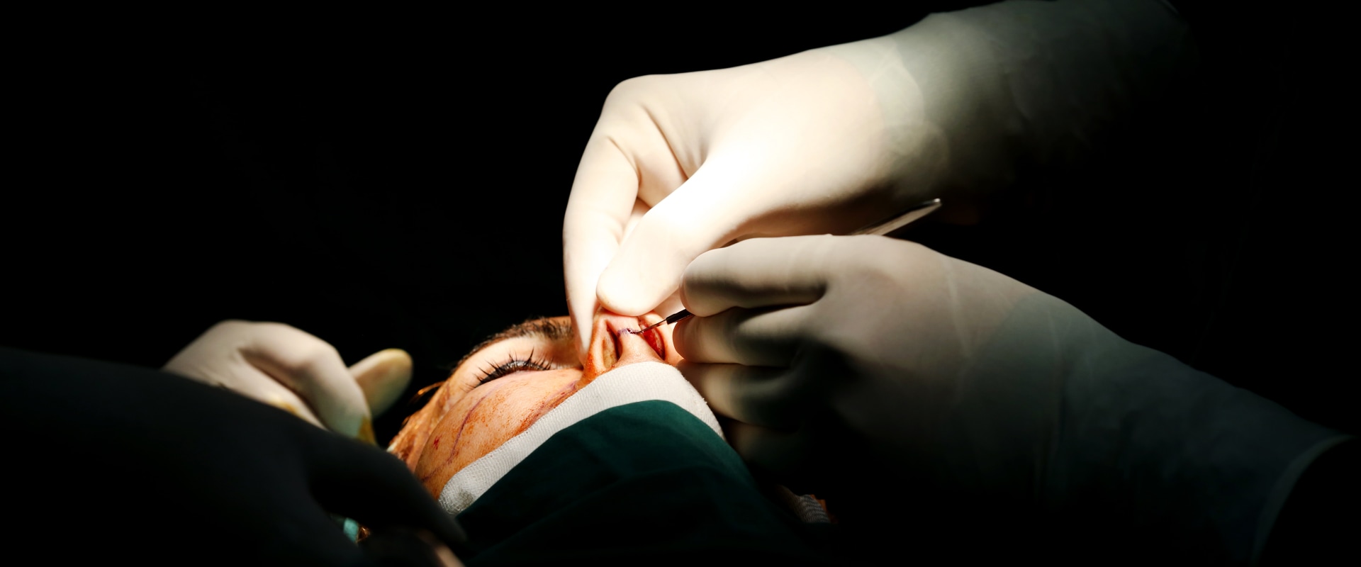 Why Cosmetic Surgery is Not Covered by Insurance