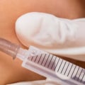 Who Can Benefit from Cosmetic Surgery?