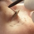 Everything You Need to Know About Plastic Surgery