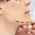 What Cosmetic Surgery Do I Need? A Comprehensive Guide