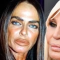 When Cosmetic Surgery Goes Wrong: The Risks and Horror Stories