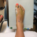 Dr Bill Releford, Podiatrist: Expert Cosmetic Surgery for Beautiful, Healthy Feet