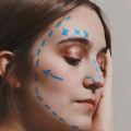 Everything You Need to Know About Plastic Surgery