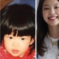 Did BLACKPINK Members Undergo Plastic Surgery?