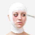 How cosmetic surgery affects society?