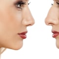 How Long Does Cosmetic Surgery Take? An Expert's Perspective