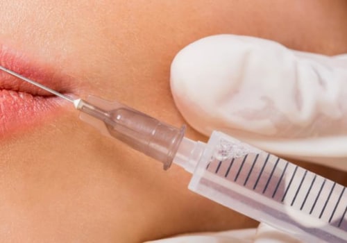 Who Can Benefit from Cosmetic Surgery?