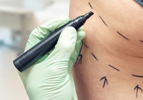 The Most Dangerous Cosmetic Surgery Procedures