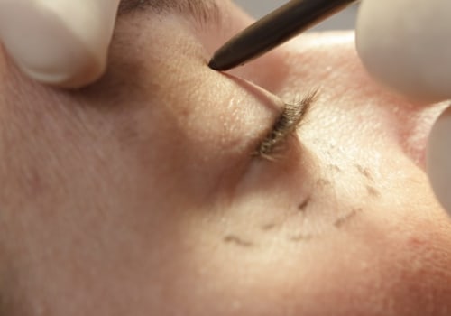 Everything You Need to Know About Plastic Surgery