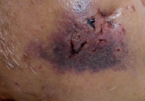 The Risks and Dangers of Cosmetic Surgery