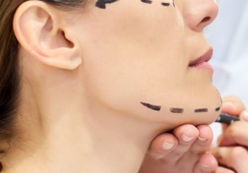 What Cosmetic Surgery Do I Need? A Comprehensive Guide