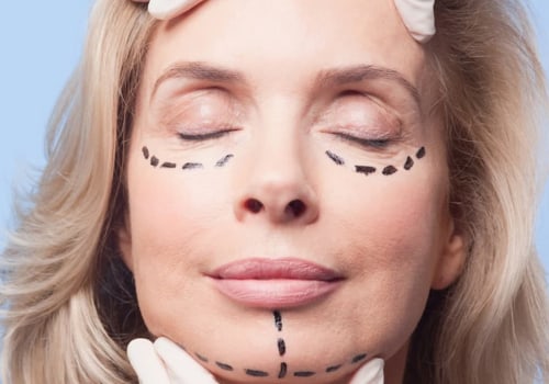 Can You Deduct the Cost of Cosmetic Surgery on Your Taxes?