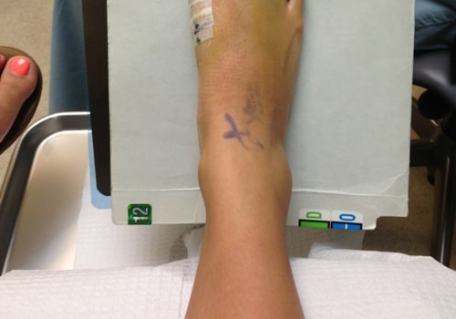 Dr Bill Releford, Podiatrist: Expert Cosmetic Surgery for Beautiful, Healthy Feet