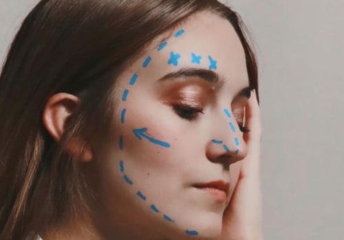 Everything You Need to Know About Plastic Surgery