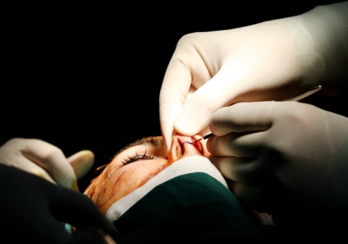 What Cosmetic Surgery Will Insurance Cover?