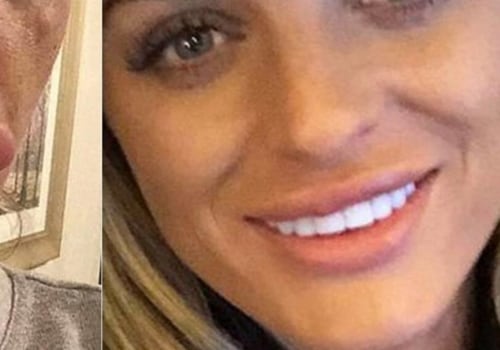 The Most Painful Cosmetic Surgeries: What You Need to Know