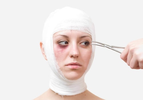 The Impact of Cosmetic Surgery on Society