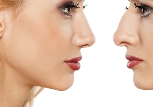 How Long Does Cosmetic Surgery Take? An Expert's Perspective